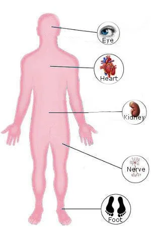 diabetescomplications