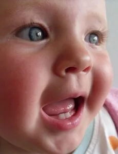 460px-Baby_teeth_in_human_infant
