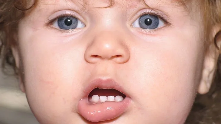 baby_teeth