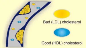 hdl_ldl_cholesterol