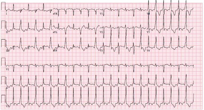 EKG29