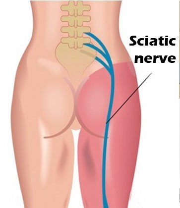 sciatic-nerve-p