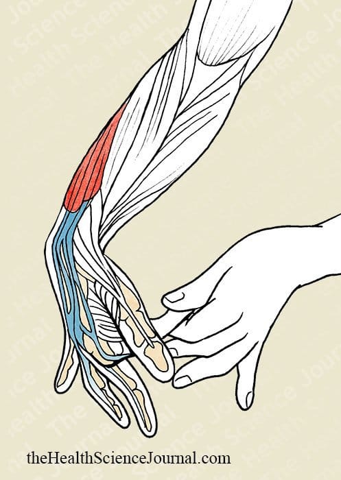 Finger by Finger Flexion With Assistance