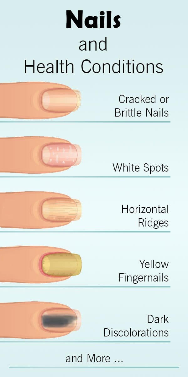 nails-health-conditions