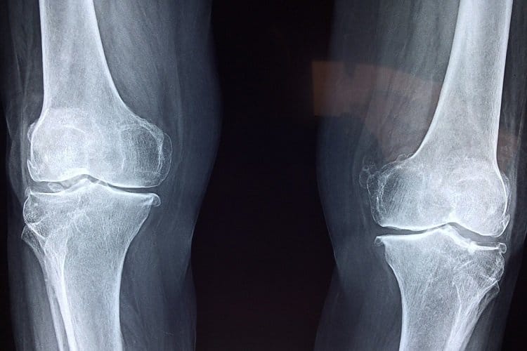 cartilage-bones