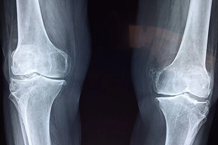 cartilage-bones