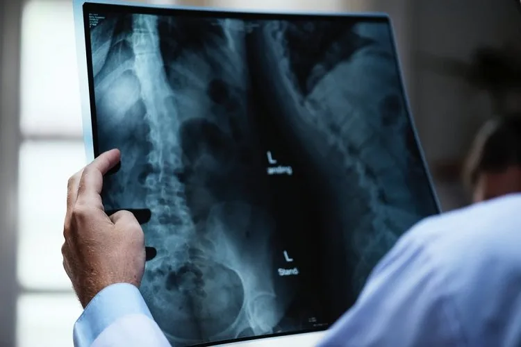 person-holding-x-ray-film