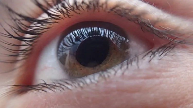 eyes