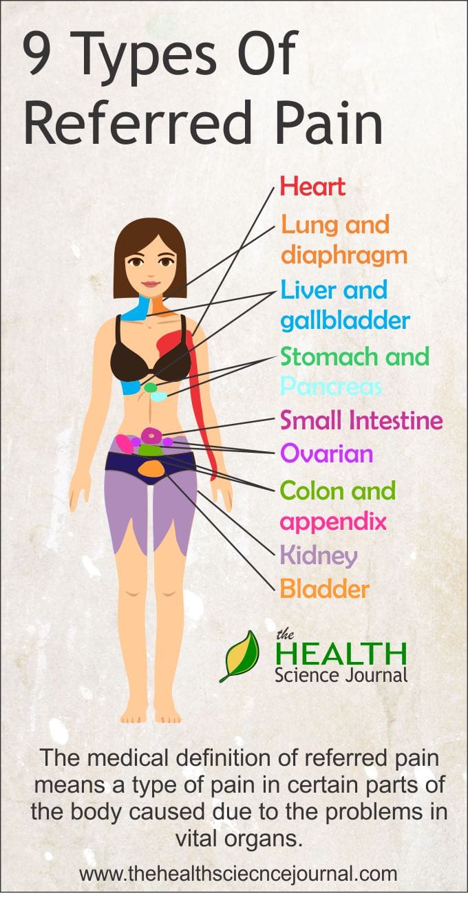 9 types of referred pain p