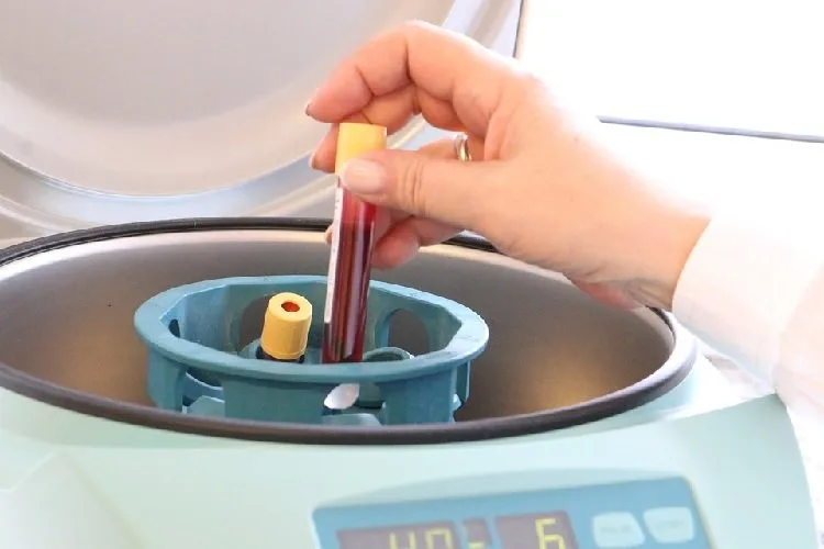 Extract Protein Samples