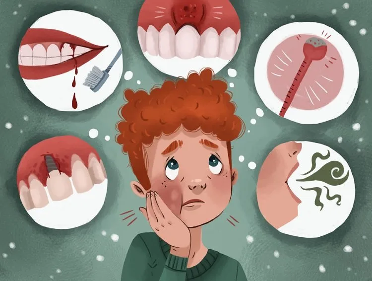 Gum Disease