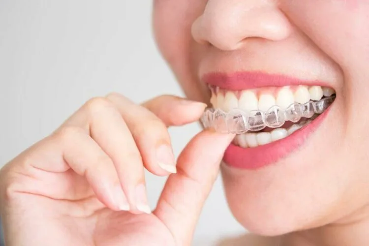 teeth braces dentist