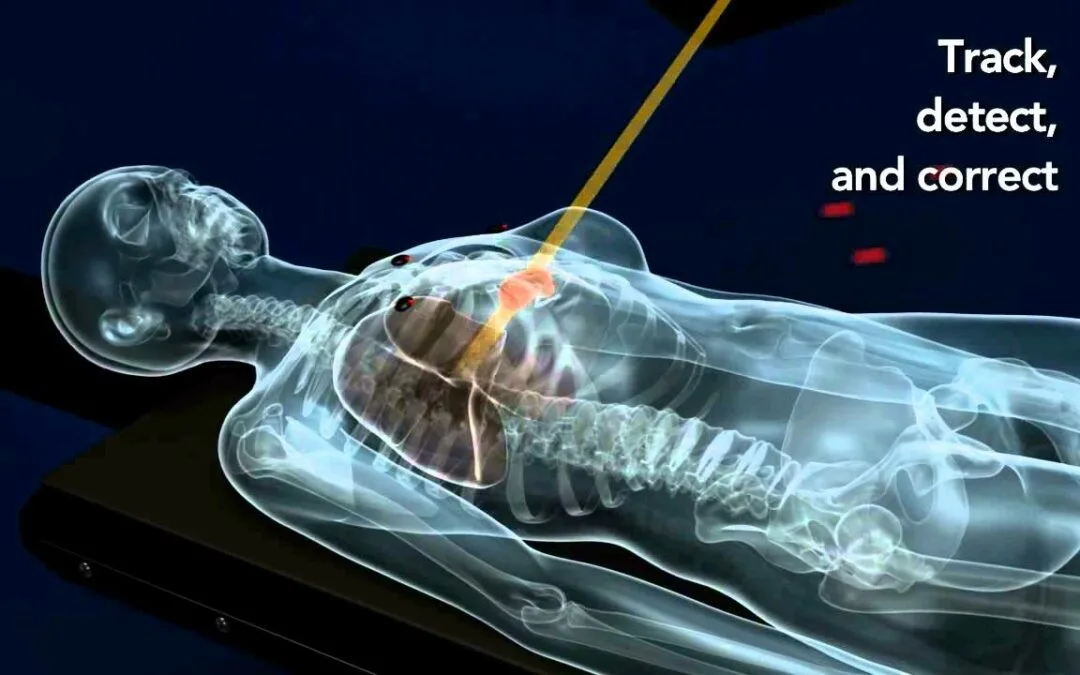 Like CyberKnife Radiation Therapy