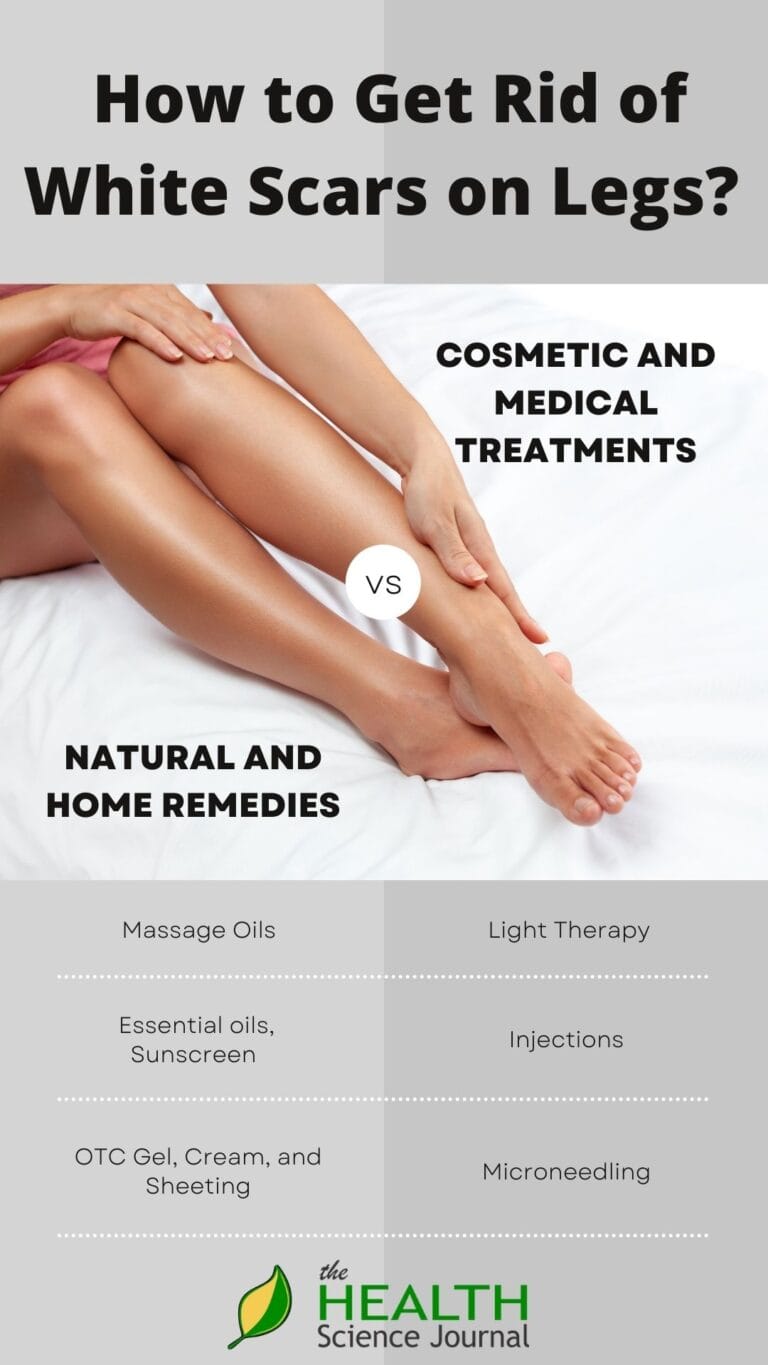 how-to-get-rid-of-white-scars-on-legs-the-health-science-journal