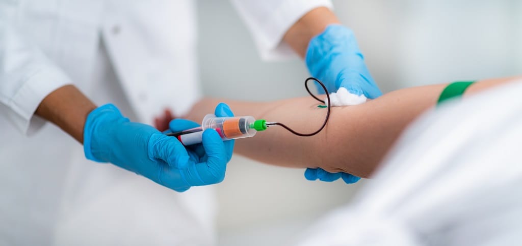 Drawing Blood for Platelet Rich Plasma Treatment or PRP