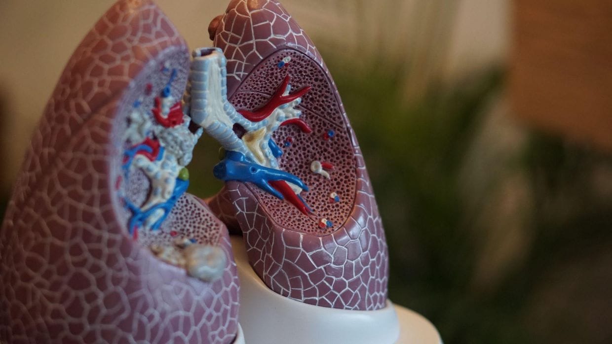 kidney