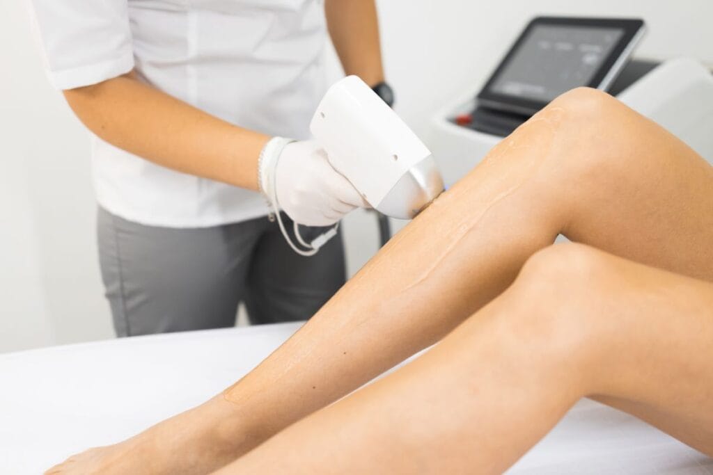 laser-hair-removal-procedure-on-a-woman-s-legs